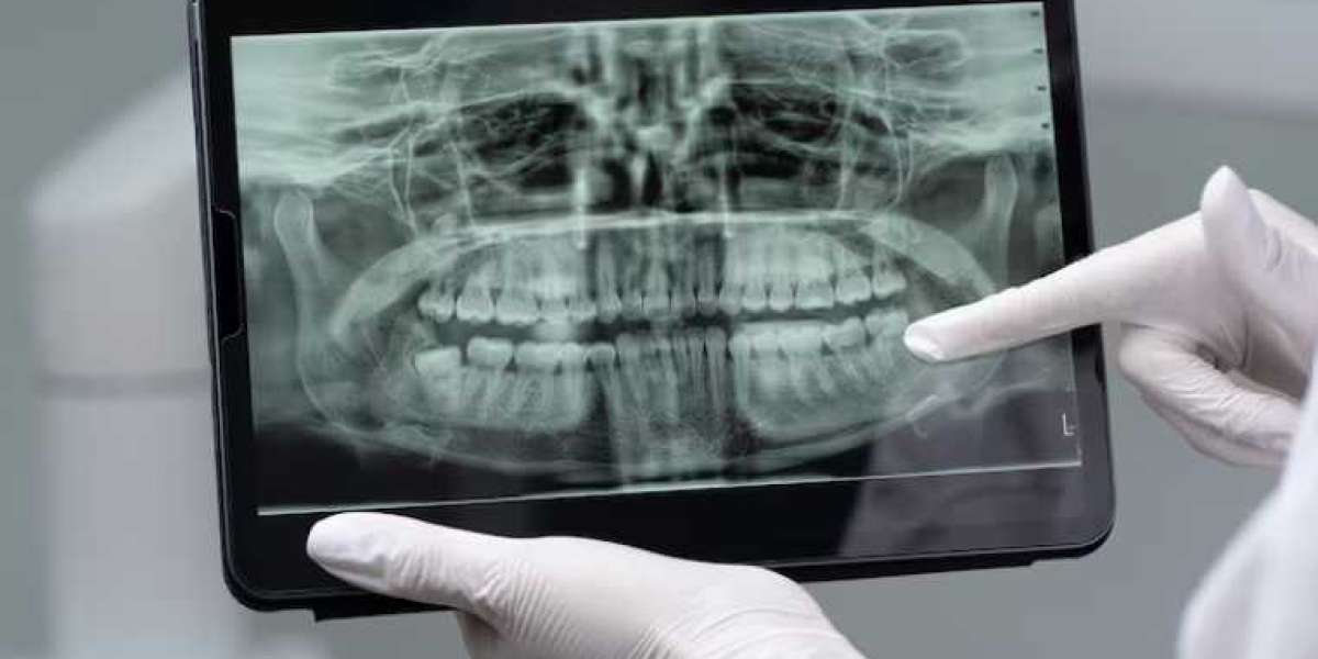 Digital Dental Radiology Services: Faster, Safer, and More Accurate Imaging