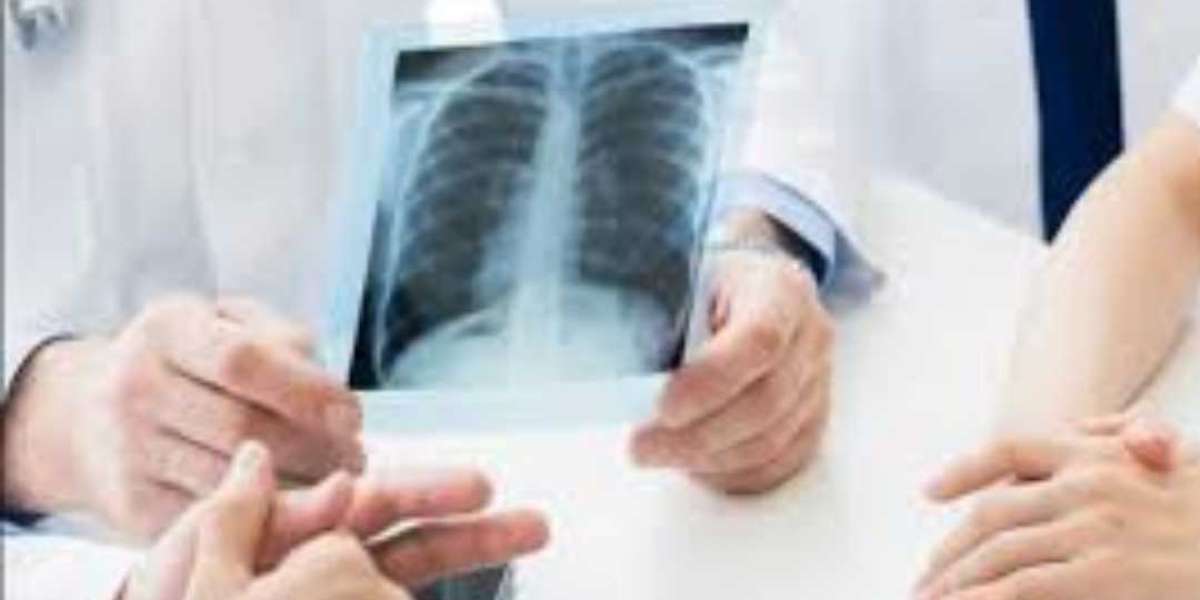 X Ray Lab Near Me: Comprehensive Guide by EcoTown