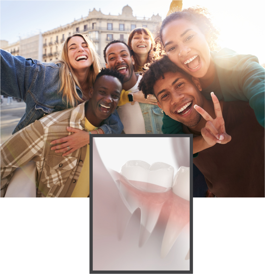 Wisdom Teeth Removal in Somerville, NJ | Lebanon NJ