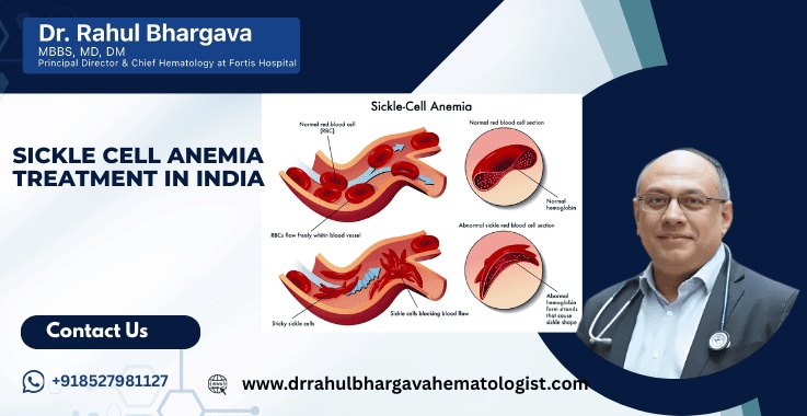 Sickle Cell Disease Treatment India for Kenyan Patients: Cost, Cure & Top Hospitals Guide - Posts Content