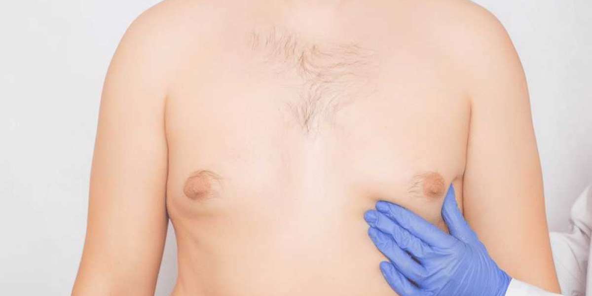Trusted Clinics for Gynecomastia In Islamabad