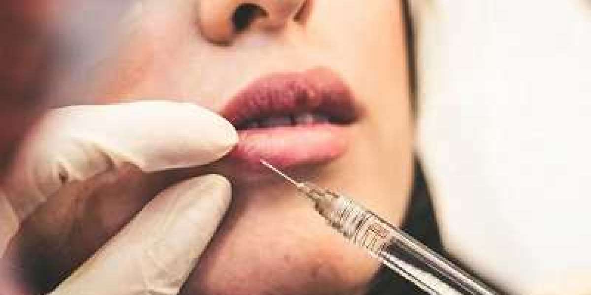 Lip Injections in Riyadh: Fresh, Fuller Lips