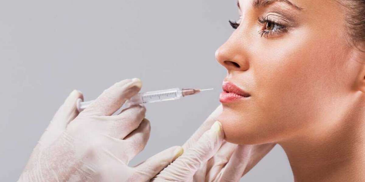Non-surgical nose reshaping with dermal fillers