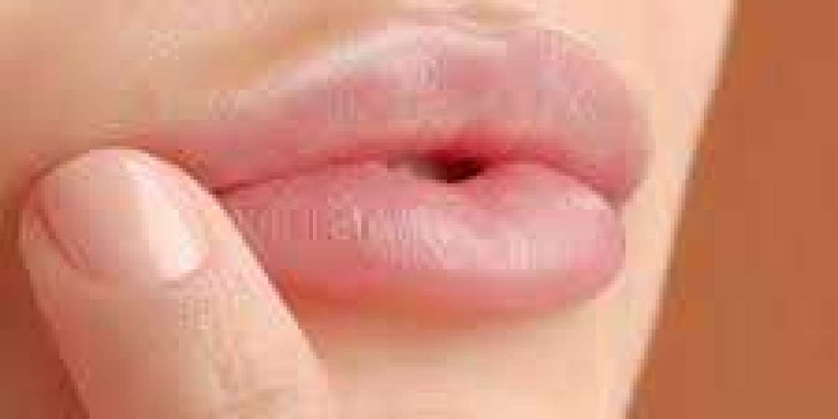 Cosmetic Laser Lip Procedures in Dubai: Modern Solutions for Beautiful, Smooth Lips