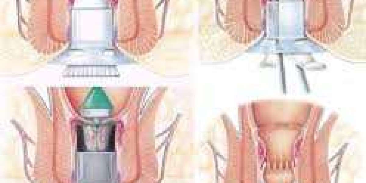 Article Picture