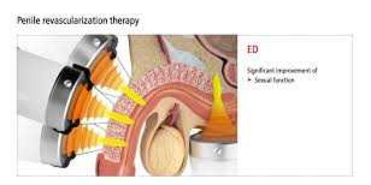 Article Picture