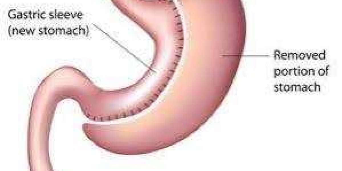 Article Picture