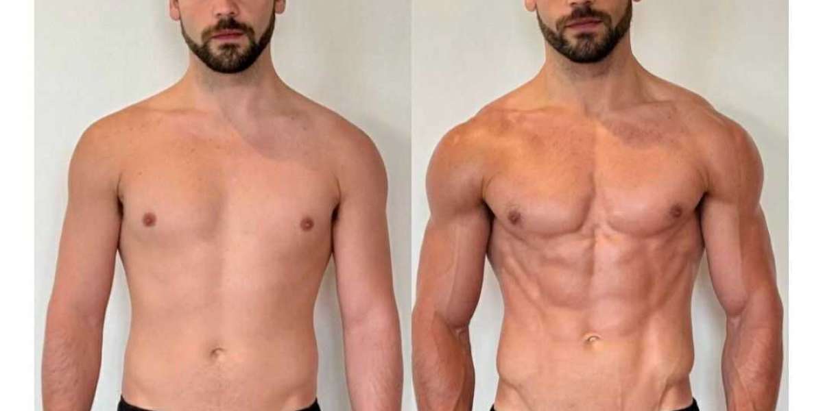 Article Picture