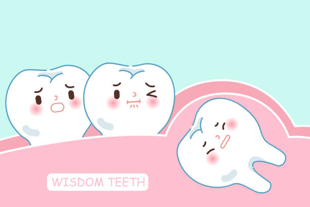 Common Wisdom Teeth Removal Mistakes to Avoid – Telegraph