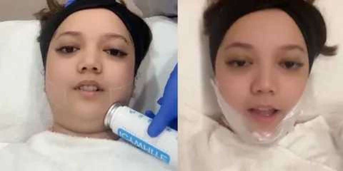 Article Picture