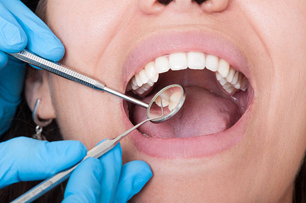 Bone Grafting in Florham Park for Dental Implants & Jaw Health