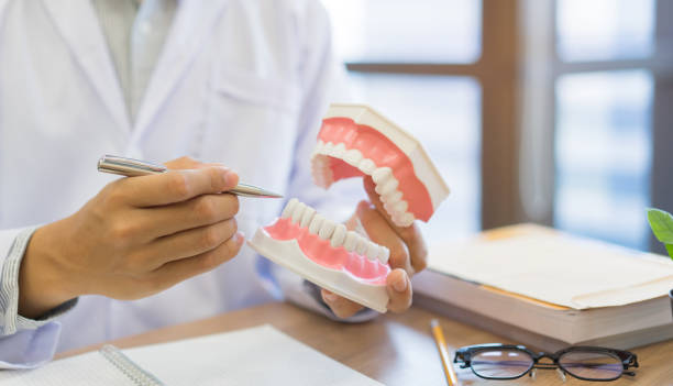 Why a Sinus Lift Bone Graft Is Needed for Upper Implants