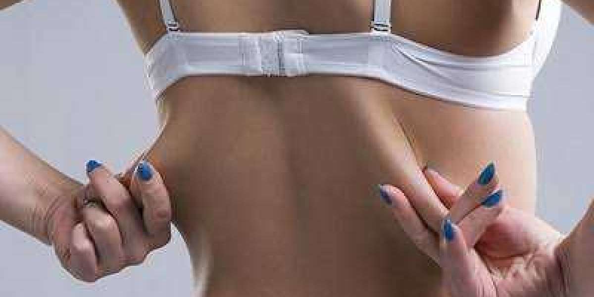 Article Picture