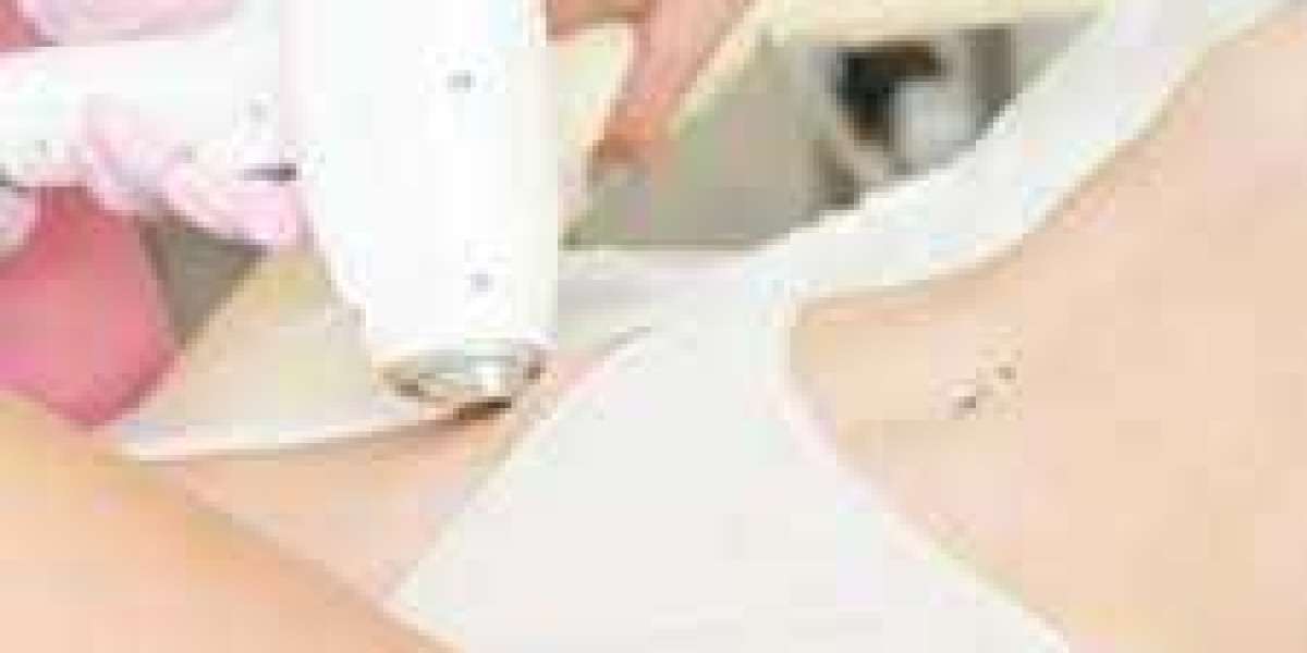 Article Picture