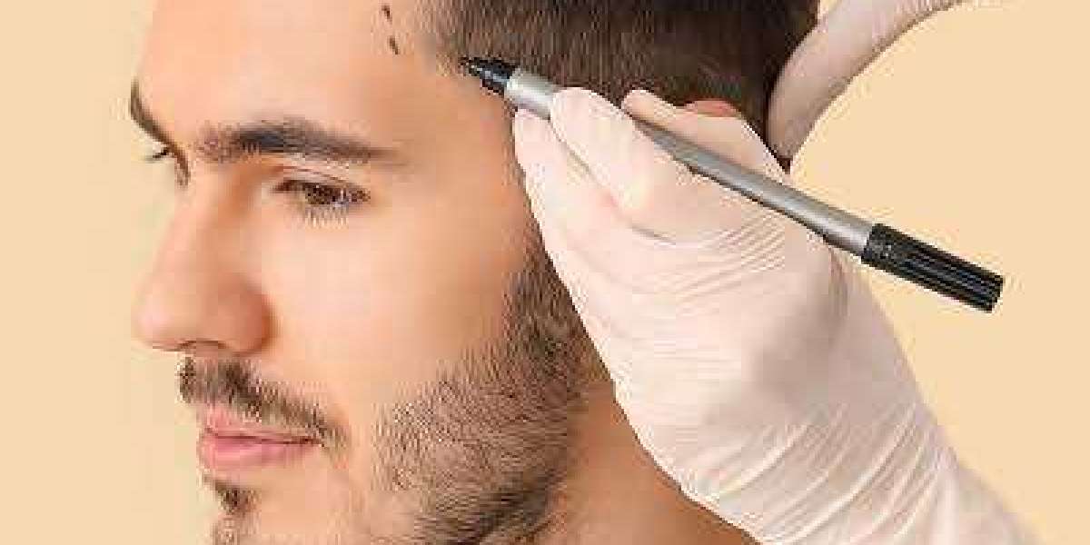 Article Picture
